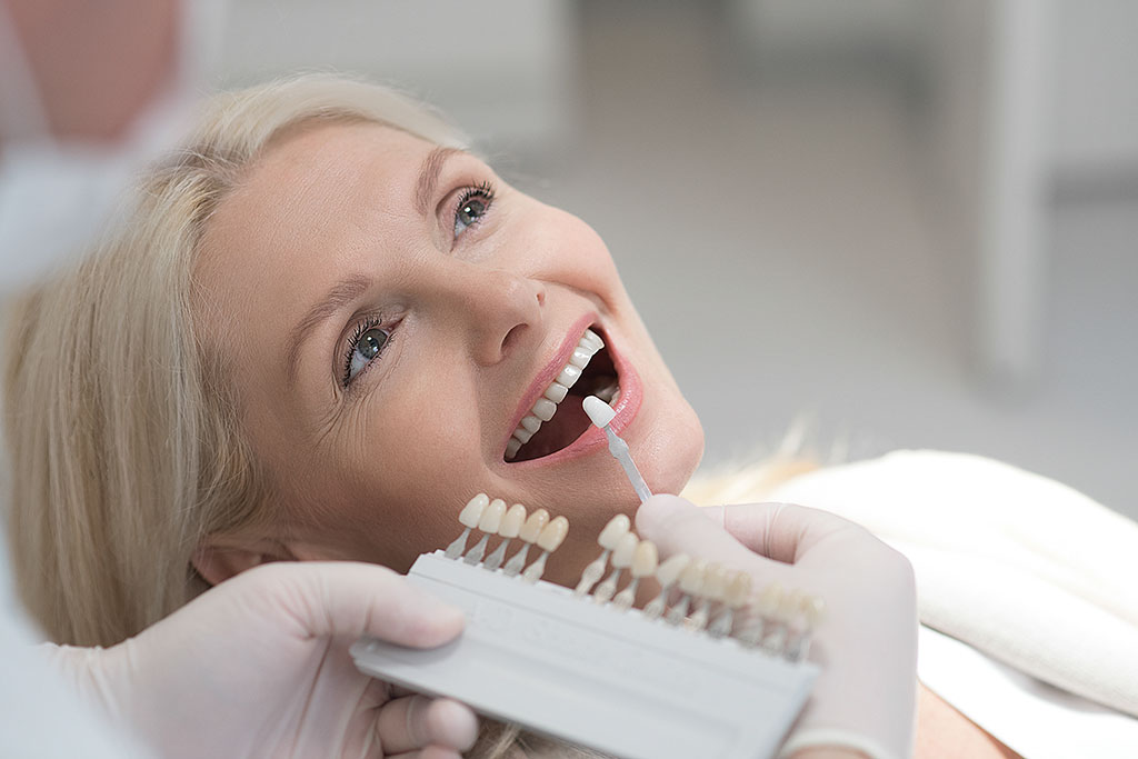 Carillas dentales: BiancaDent, Dentistas Castellón