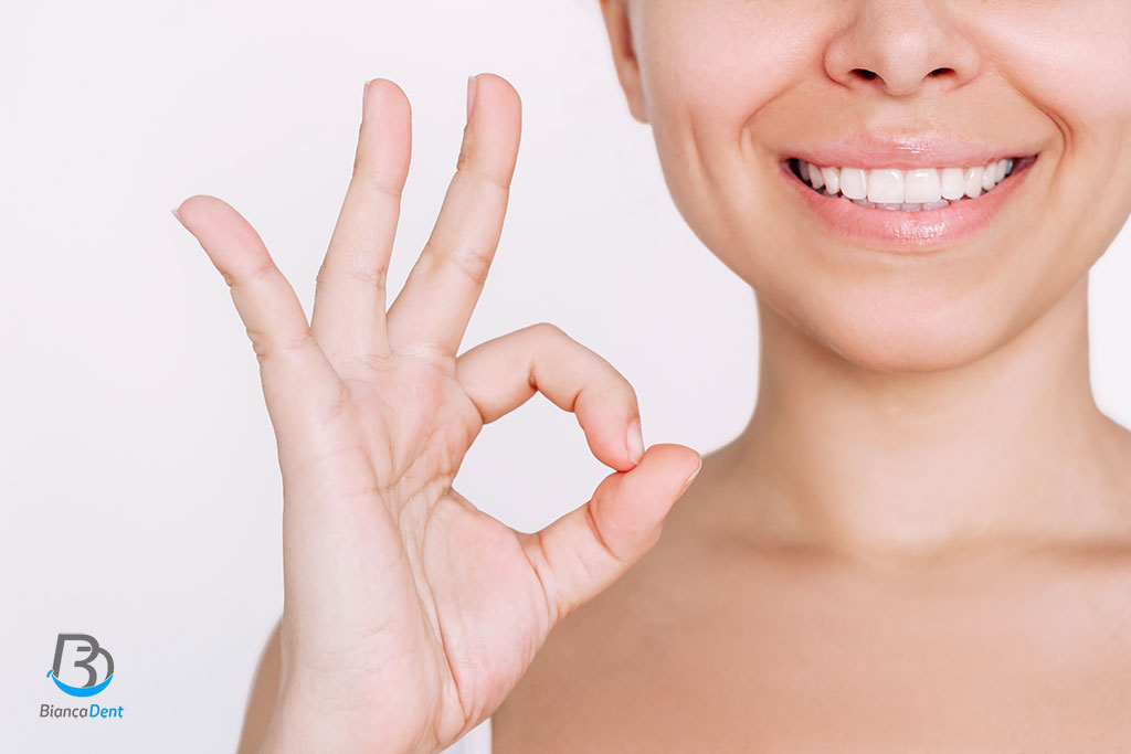 Carillas de composite: BiancaDent, Estética Dental Castellón