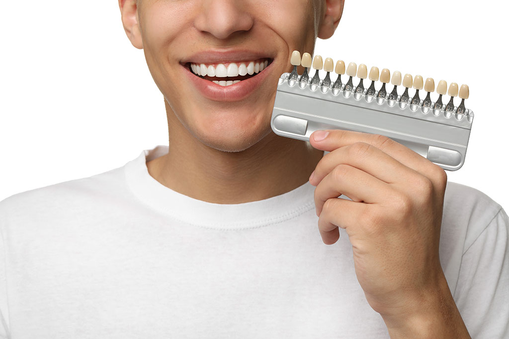 Carillas dentales: BiancaDent, Clínica Dental en Castellón