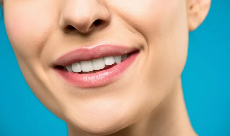 estetica dental en castellón