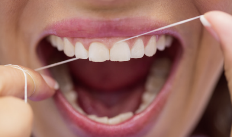 persona utilizando hilo dental entre dos muelas durante su higiene oral
