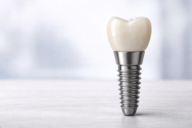 implantes dentales cicatrizar